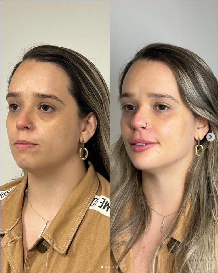 Antes e depois — paciente 3